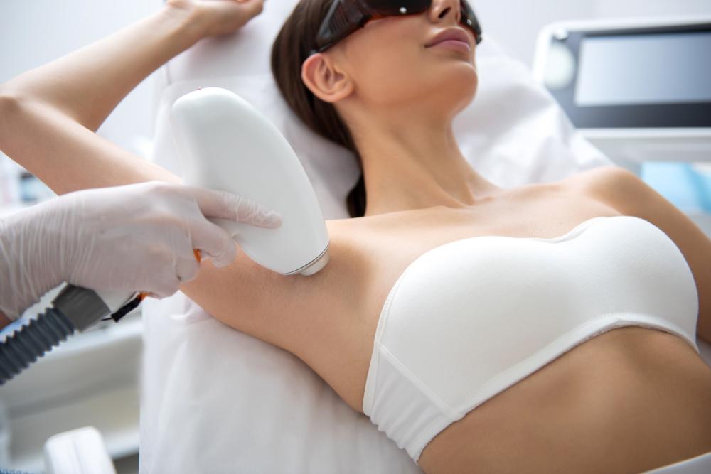 Epilation lumière pulsée